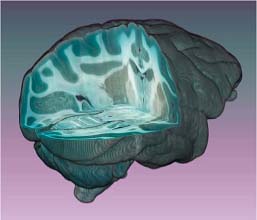 Neuroanatomical Methods